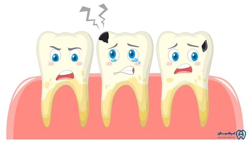 چه زمانی دندان پوسیده میشود؟