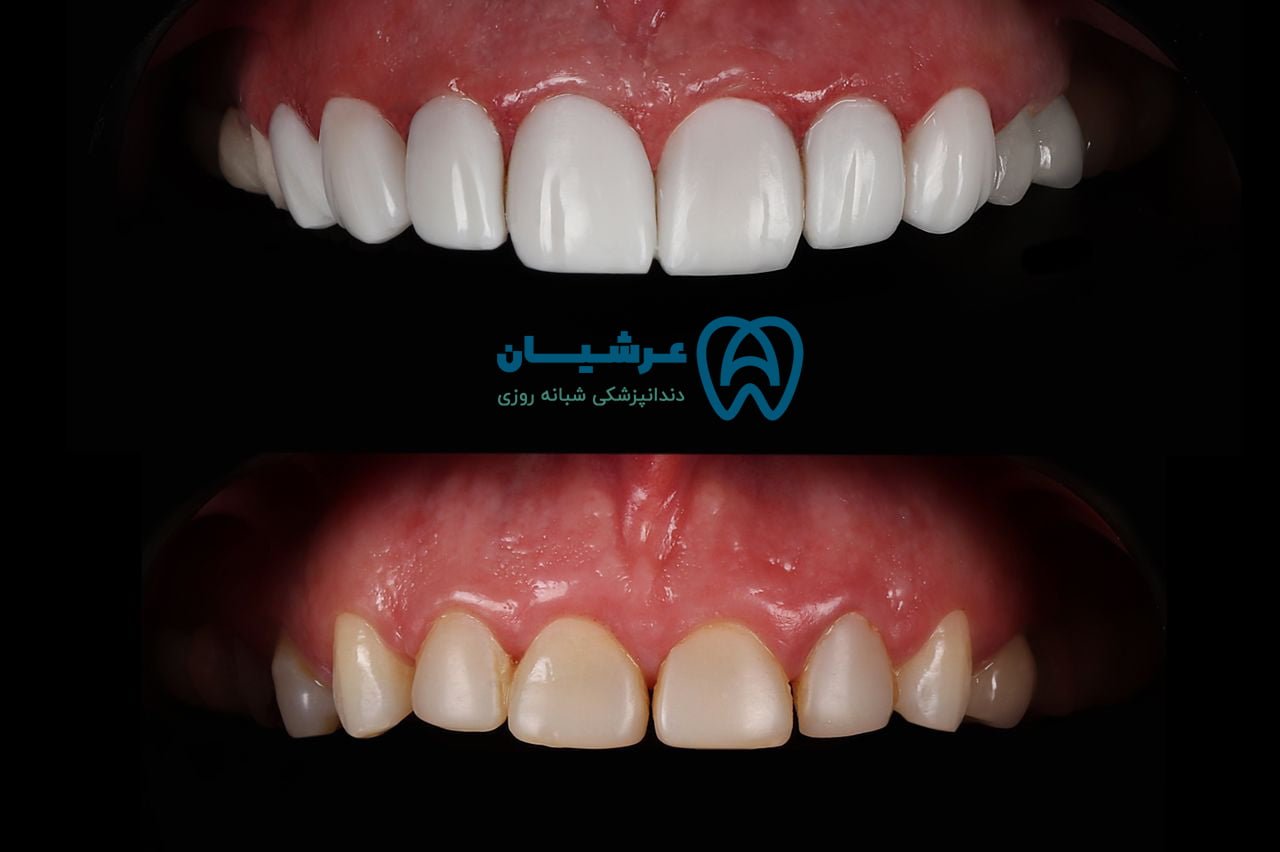 تخفیف قیمت دندانپزشکی تهران