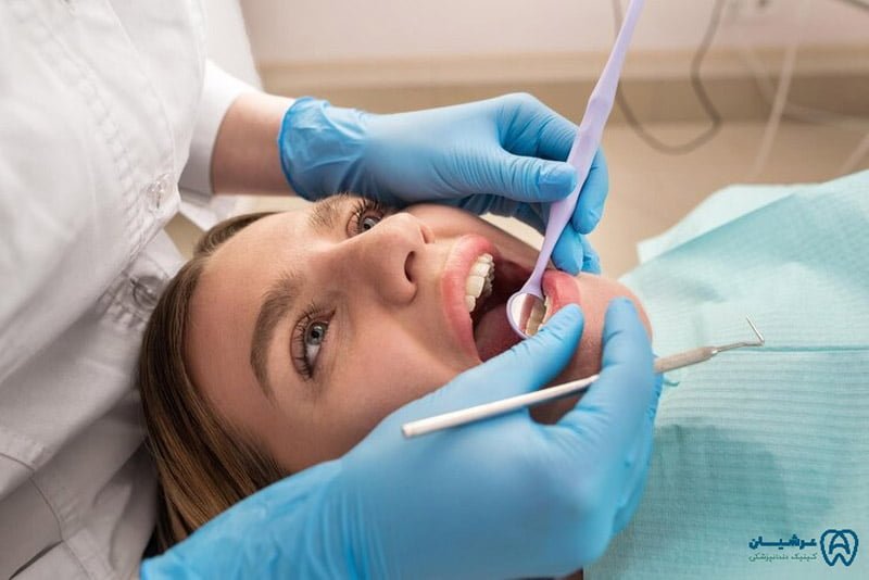 سفید کردن دندان در دندانپزشکی