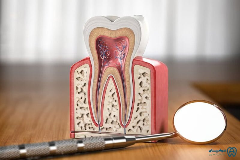 علت ورم و درد دندان بعد از عصب کشی