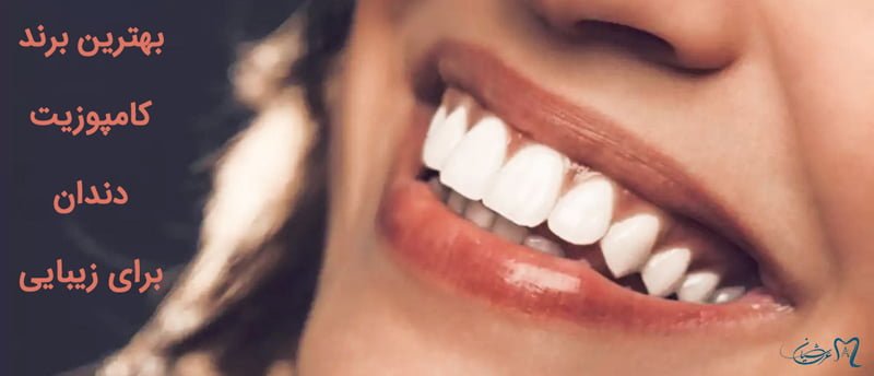 بهترین برند کامپوزیت دندان برای زیبایی