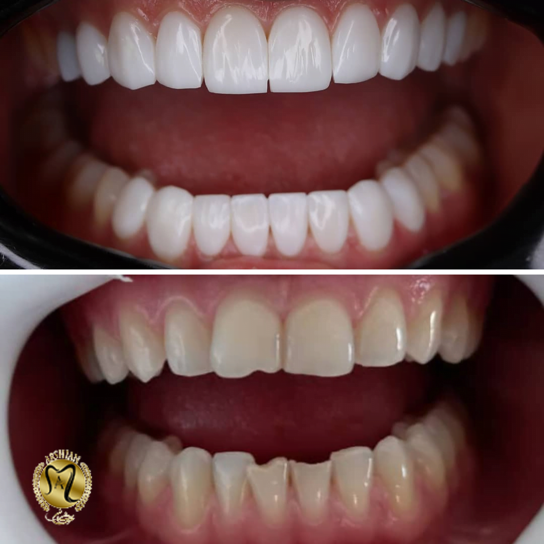 دندان های زیبا