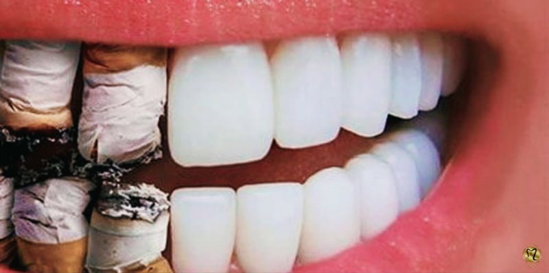 سیگار و قلیان کشیدن بعد از کشیدن دندان 