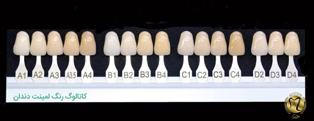 تفاوت رنگ دندان a1 و b1