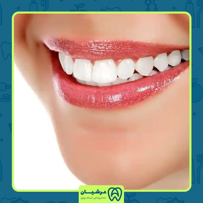 کامپوزیت دندان از چه سنی مناسب است؟