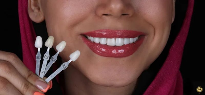 کامپوزیت دندان به روش لیرینگ چیست؟
