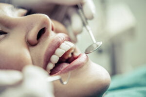 ۱۰ عامل تخریب کننده ایمپلنت دندان 3