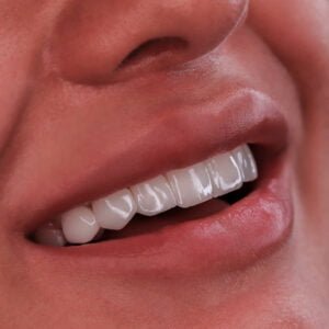تراش دندان