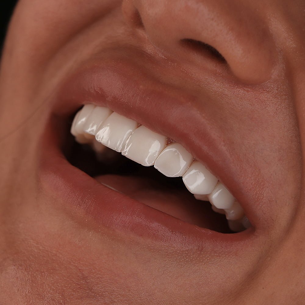 تراش دندان