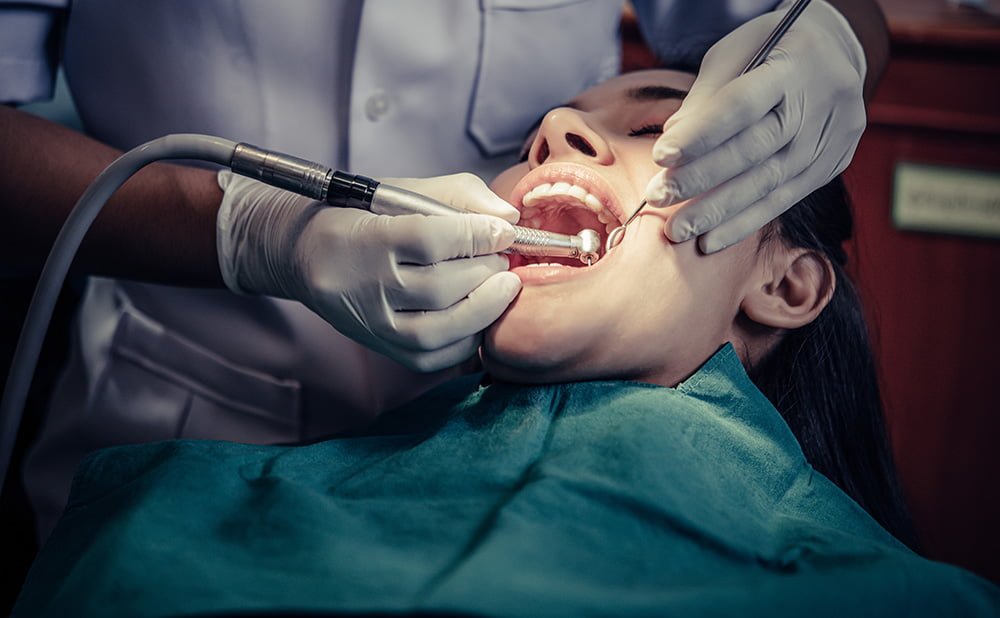 همه چیز در مورد عصب کشی دندان 2