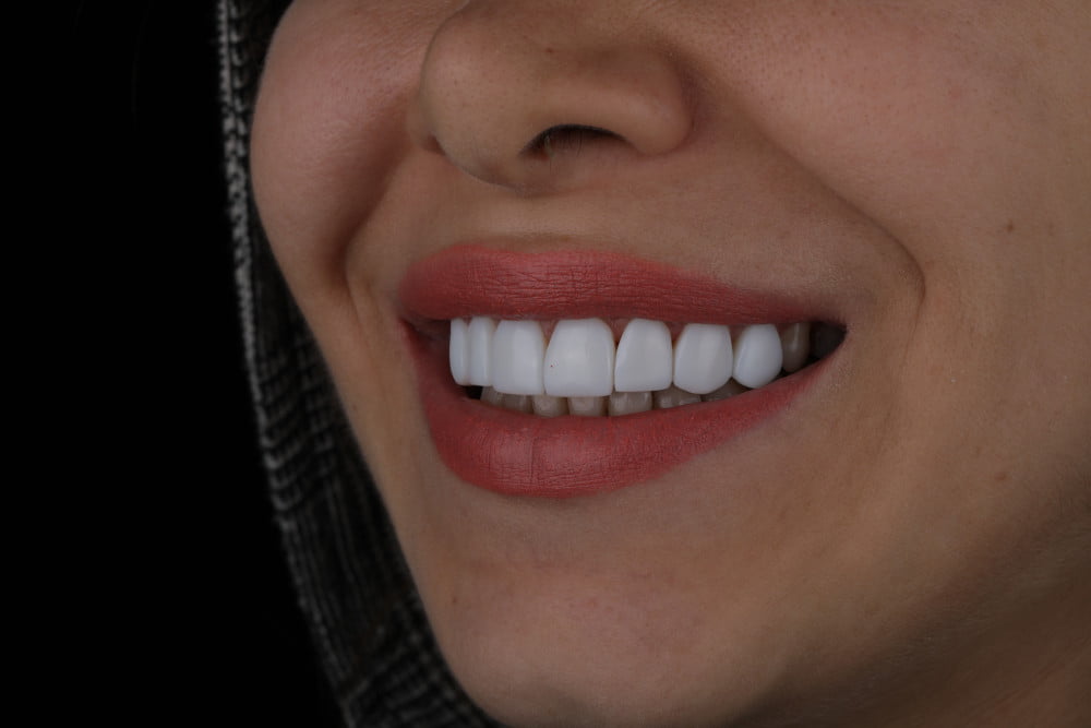 خمیر دندانی مخصوص کامپوزیت دندان
