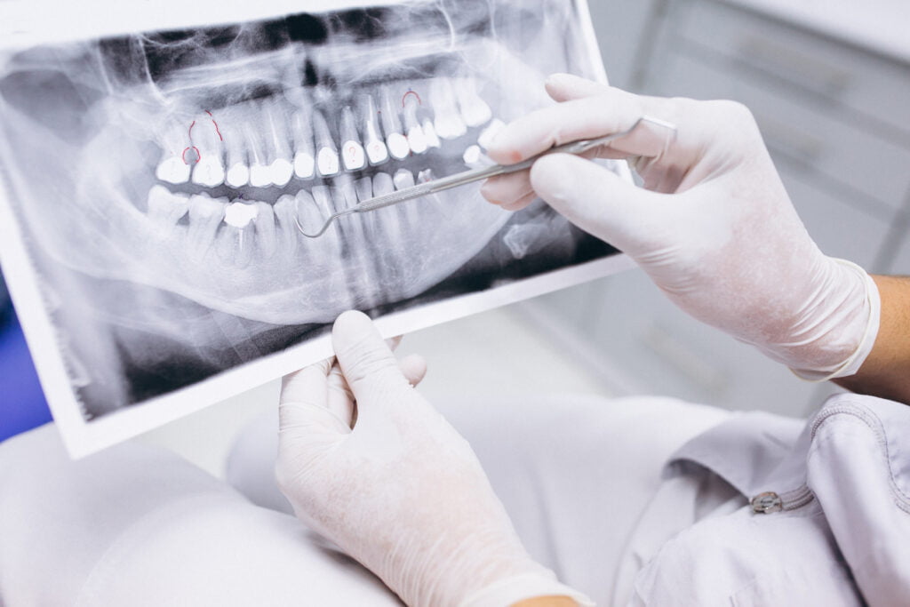 اهمیت معاینه دندانپزشکی