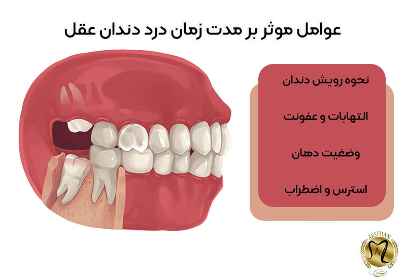 درد دندان عقل چند روز طول میکشد